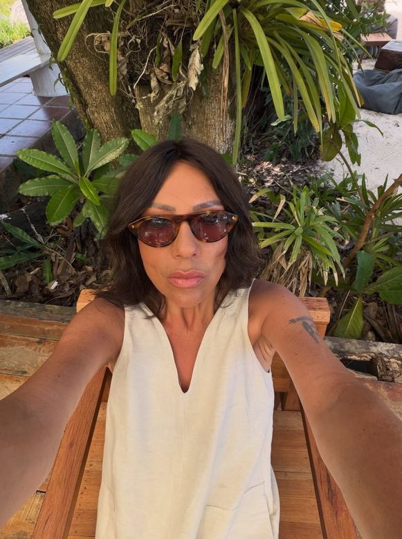 73 kilo veren Işın Karaca iğne ipliğe döndü! Son halini görenler şoke oldu - Resim: 6