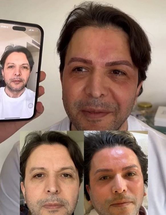 Değişimiyle gündem olmuştu! Nihat Doğan neden estetik yaptırdığı açıkladı! - Resim: 5