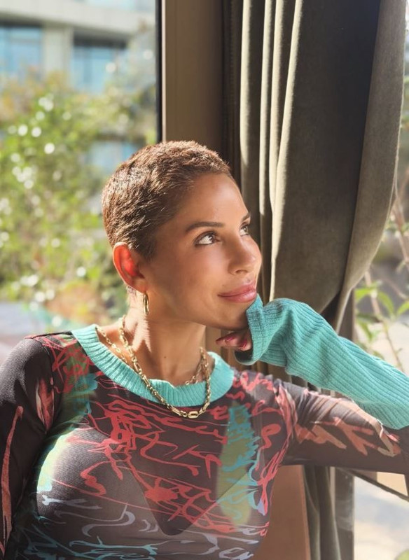 Aylardır meme kanseriyle mücadele ediyordu! Ünlü oyuncu Irmak Ünal'dan duygulandıran paylaşım - Resim: 4