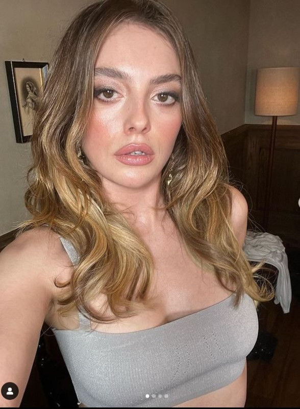 Melis Sezen'in son paylaşımını gören "Yüzüne ne olmuş?"  demeden edemedi - Resim: 4