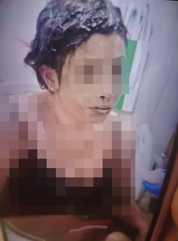 Gaziantep'i sarsan eski koca vahşeti: Kadını bağladı, kezzap döktü! - Resim: 3