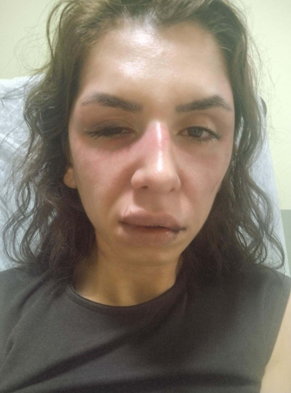 Bu gece katliam yapacağım! Eşine dehşeti yaşattı: Önce kemer ve kablo, sonra bıçak... Canin cezası belli oldu - Resim: 4