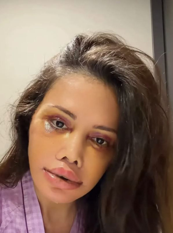 Yüz nakli sonrası hayatını kabusa dönmüştü! Didem Ceran Bali'de arınma ritüeline katıldı - Resim: 2