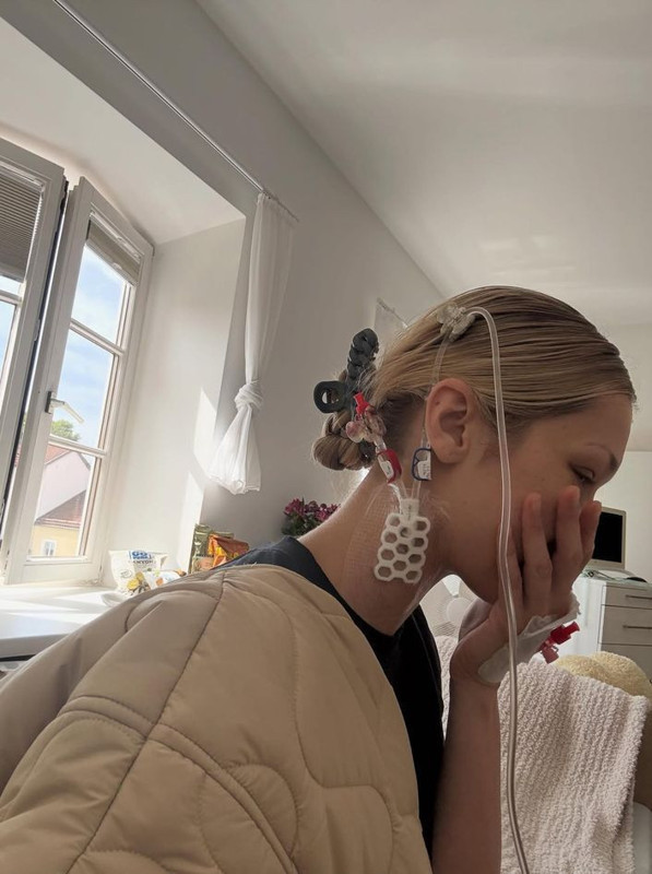 Lyme hastalığıyla mücadele ediyordu! Ünlü model Bella Hadid'den yürek burkan paylaşım - Resim: 5