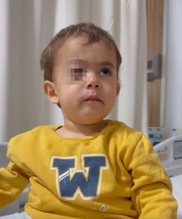 İnegöl’de torpil faciası! 2 yaşındaki Alpaslan gözünü kaybetti! Baba, fırıncıyı daha önce uyarmış! - Resim: 2