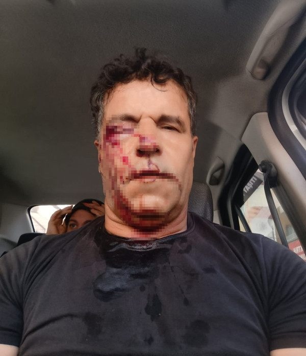 Taşla parçalamak istediler! Kemikleri kırıldı: Eşi son anda yetişti - Resim : 1