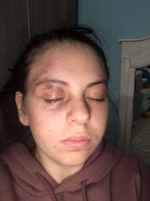 Milli sporcu, eşine kabusu yaşattı! Işık neden açık kaldı?' diyerek dövüyordu! - Resim: 4