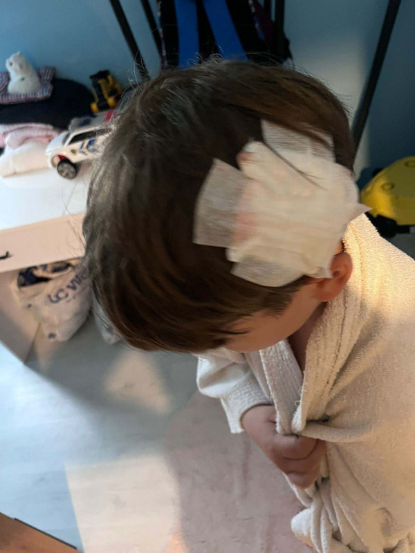 Yalova'daki komşu dehşeti sürüyor!  Bu kez 8 yaşındaki çocuklarına taşla saldırdılar - Resim: 3