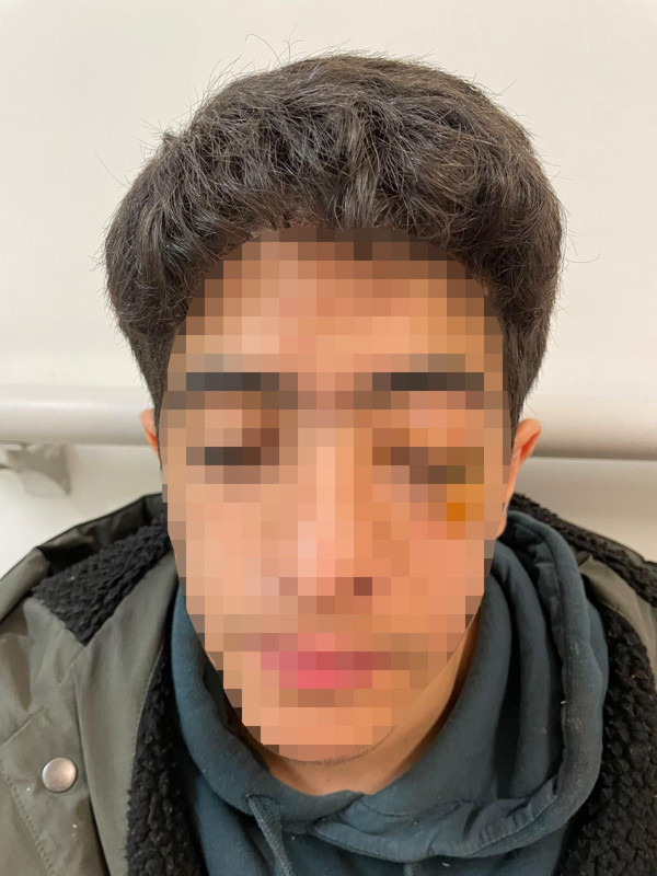 Esenyurt’ta akran zorbalığı dehşeti! "Bana şaka yapma" deyince muştalı saldırıya uğradı - Resim: 3