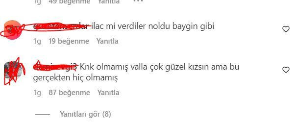 Melis Sezen'in son paylaşımını gören "Yüzüne ne olmuş?"  demeden edemedi - Resim: 9