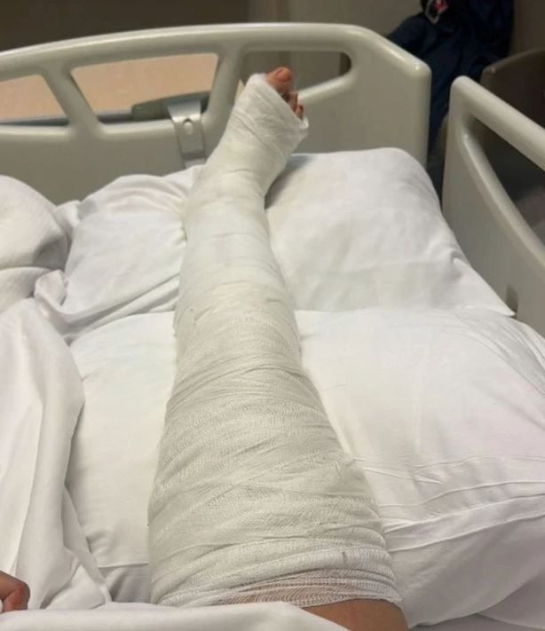 Ayağı iki yerden kırılmıştı! Yasemin Yürük'ten korkutan paylaşım: Aklımı kaçırmak üzereyim! - Resim: 3
