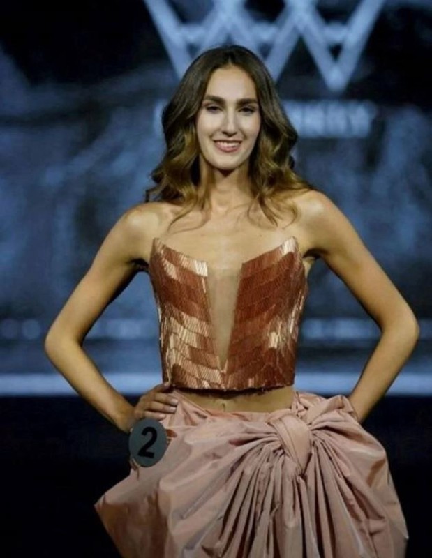 Miss Turkey Birincisi olduktan sonra "Çirkin" diye eleştirilmişti. İdil Bilgen hakkında dikkat çeken gelişme - Resim: 3