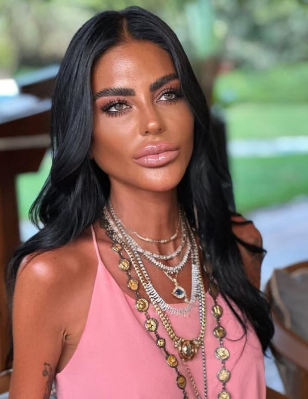 Sosyetik güzel Süreyya Yalçın'ın son hali sevenlerini endişelendirdi! Aşırı zayıflığı olay oldu - Resim: 3