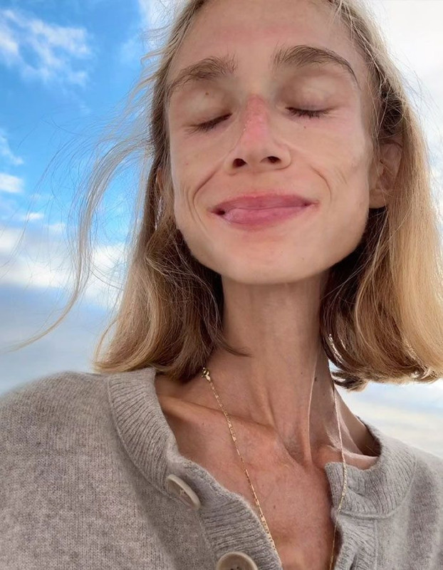 22 kiloya kadar düşmüştü! Sosyal medya fenomeni hayatını kaybetti - Resim: 4