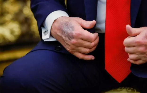 Sosyal medya bu iddia ile çalkalanıyor! Tüm dünya aynı soruyor: Donald Trump nerede? - Resim : 1