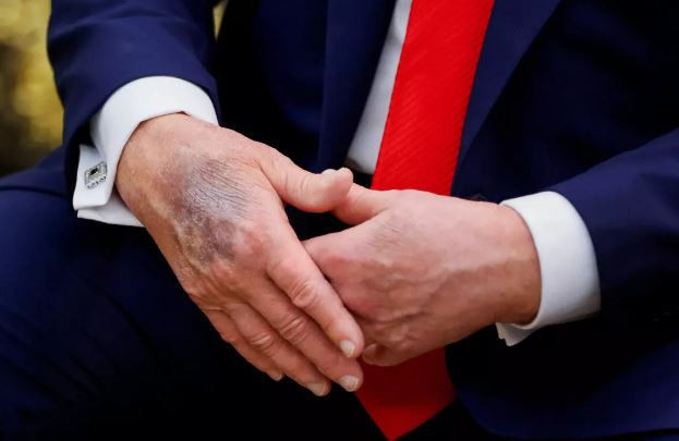 Sosyal medya bu iddia ile çalkalanıyor! Tüm dünya aynı soruyor: Donald Trump nerede? - Resim : 2