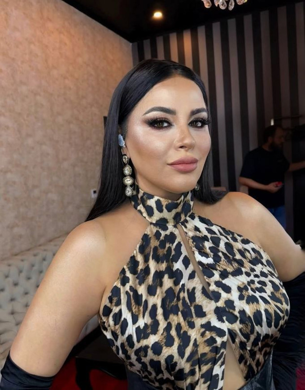 3 ayda 16 kilo vermişti! Ünlü şarkıcı Zara'nın zayıflama sırrı ortaya çıktı! Son halini görenler şaştı kaldı - Resim: 3
