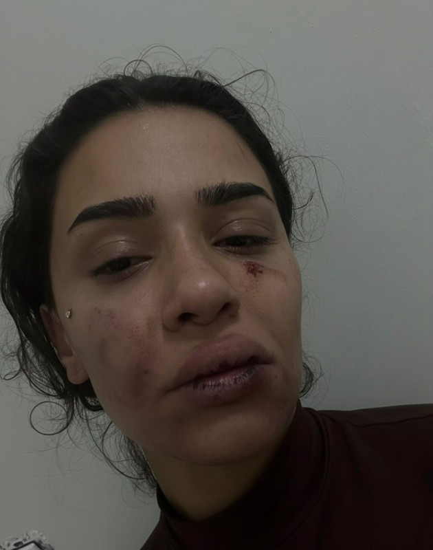 Eski sevgiliden öldüresiye darp! Hemşire Ebru’nun yardım çığlığı: Ölmek istemiyorum - Resim: 2