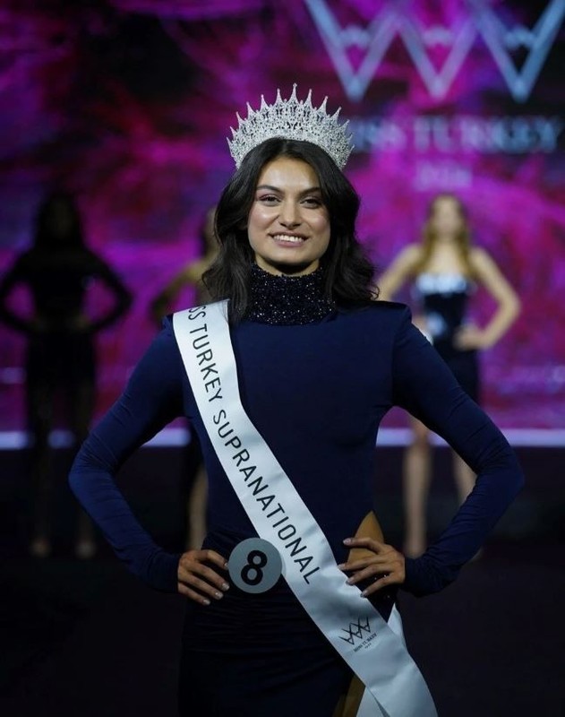 Miss Turkey'de herkesi şoke eden olay! Cemre Üker'in güzellik ünvanı geri alındı - Resim: 1