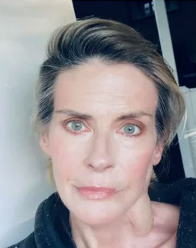 Beyin tümörüyle mücadele ediyordu! Ünlü oyuncu hayatını kaybetti - Resim: 7