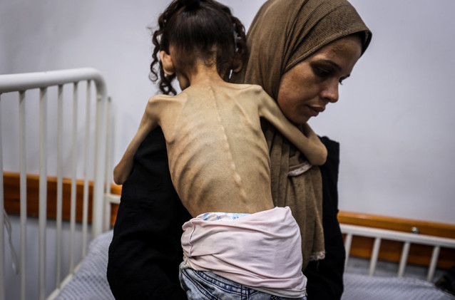Gazze'de açlık yavaş yavaş öldürüyor!  9 yaşındaki Meryem 10 kiloya düştü! 'Bu benim kızım mı?' - Resim : 4