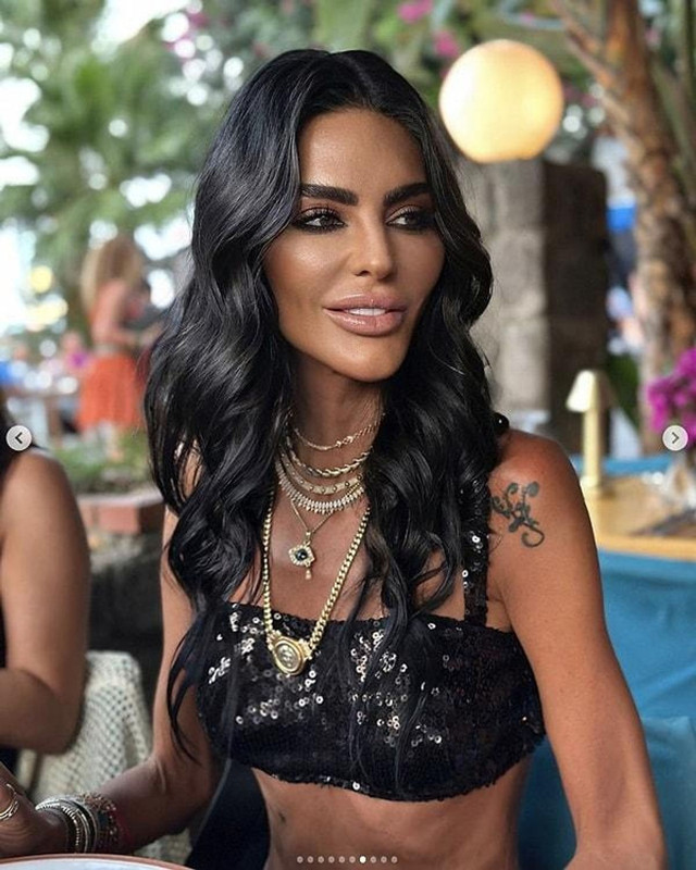 Sosyetik güzel Süreyya Yalçın'ın son hali gündem oldu! Aşırı zayıflığı yorum yağmuruna tutuldu - Resim: 2