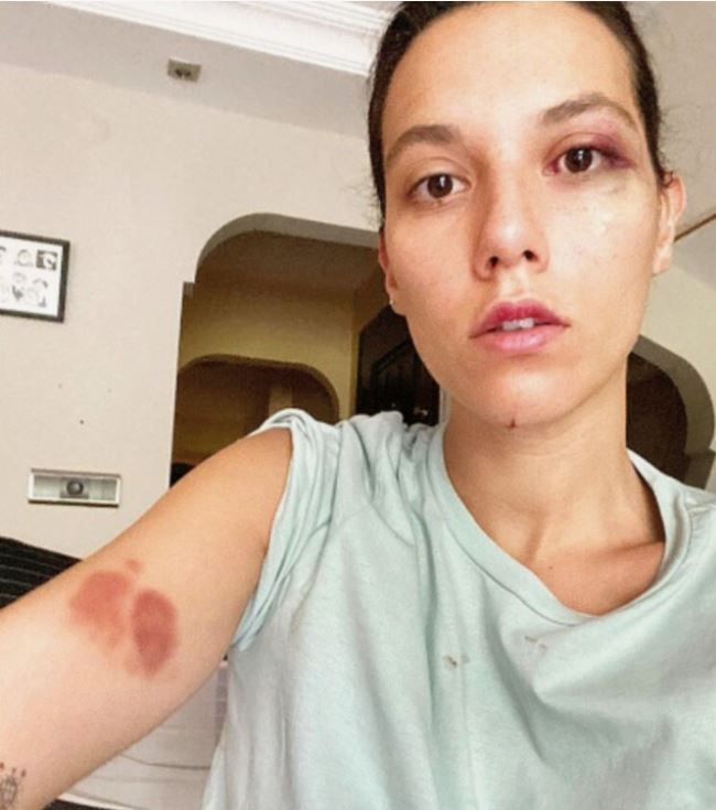 Eski sevgilisi Ozan Güven’le davalık olmuştu! Deniz Bulutsuz sessizliğini bozdu! "Cezaevine gireceği günü bekliyorum" - Resim: 3