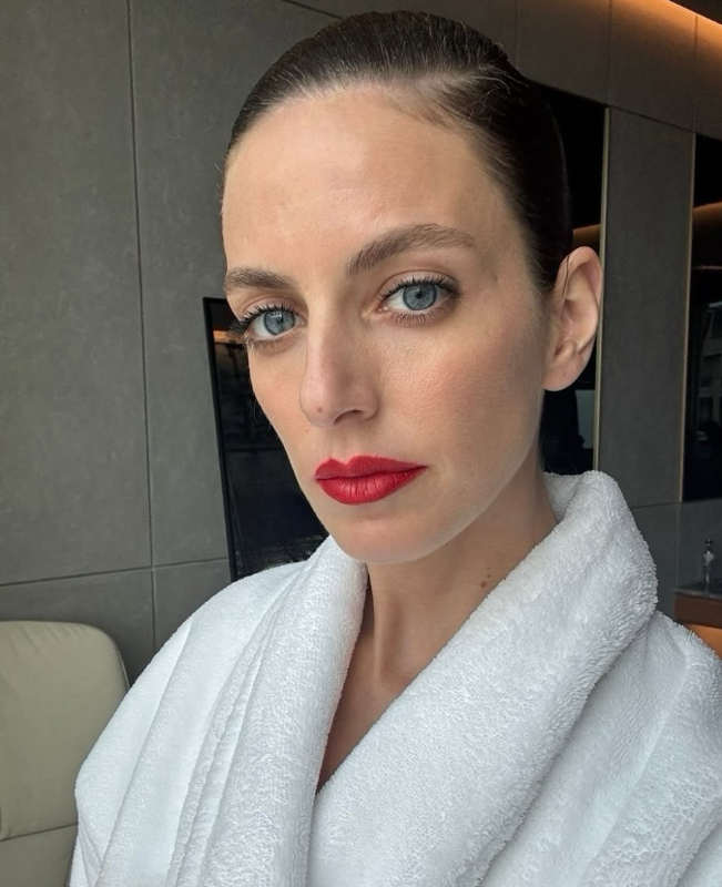 Tatilde talihsiz kaza! Bige Önal hastaneye kaldırıldı - Resim: 2