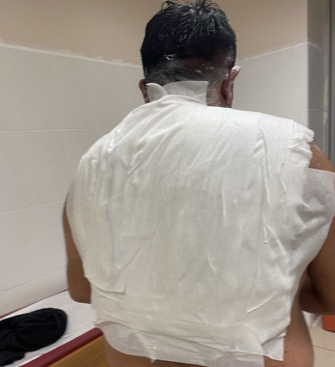 Fenomen tostçunun sıcak su deneyi felaketle bitti! Havaya attı, acı içinde kıvrandı - Resim: 4