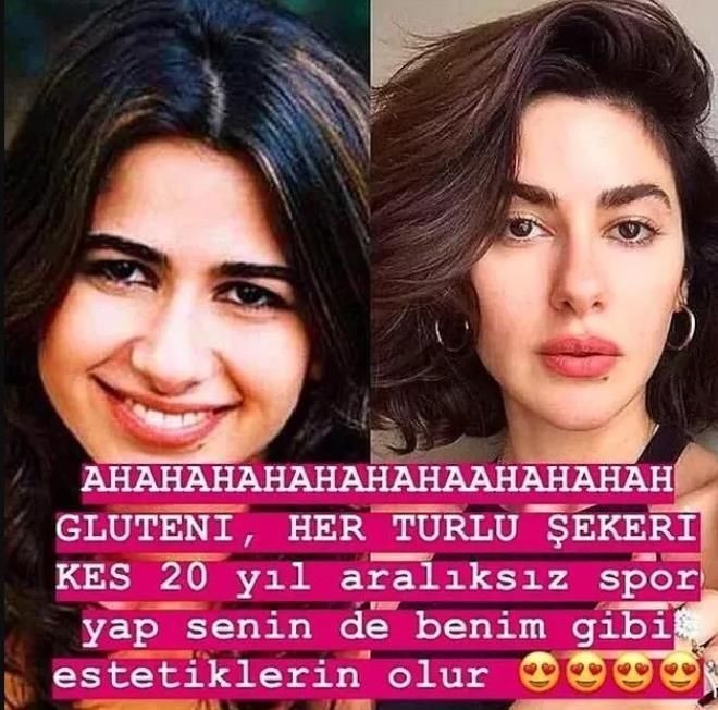 Üç Kuruş'un Bahar'ı Nesrin Cavadzade estetik iddialarını yalanlamıştı! O fotoğraflar ortaya çıktı! Görenler şok oldu - Resim: 7