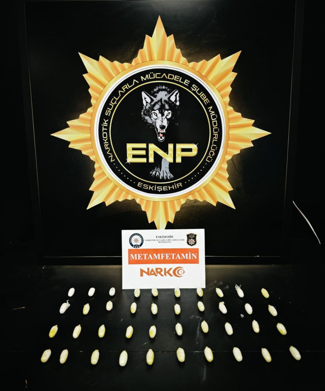 Röntgende ortaya çıktı! Midesinden çıkanlar şoke etti - Resim: 2