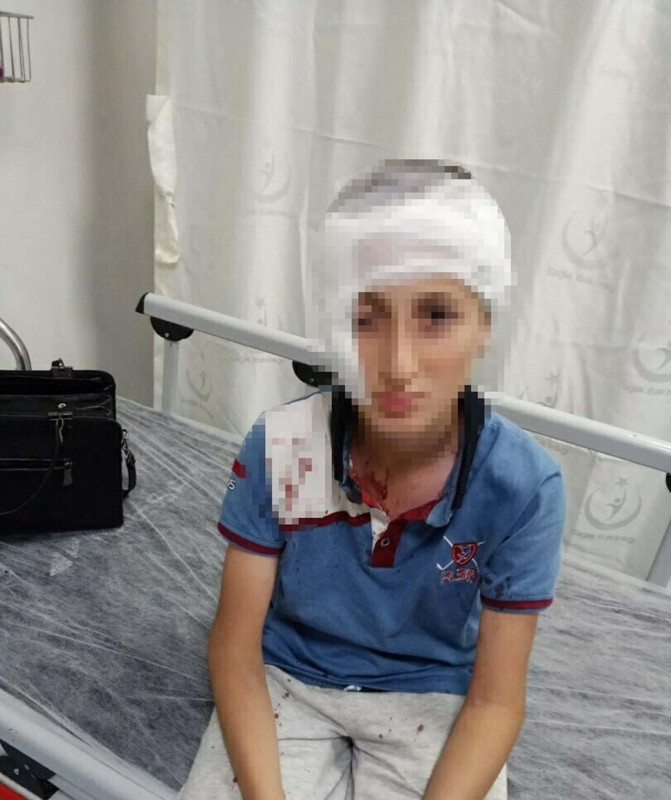 11 yaşındaki çocuk köpek saldırısında yaralanmıştı! Mahkemeden emsal karar: Köpek sahibine rekor tazminat - Resim: 4