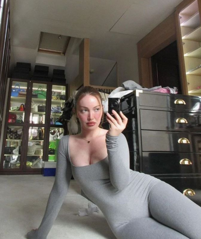 Kalça dolgusu kaburgasına çıkmıştı! Danla Bilic'ten üç yıl sonra itiraf geldi! O doktoru ifşa etti - Resim: 1