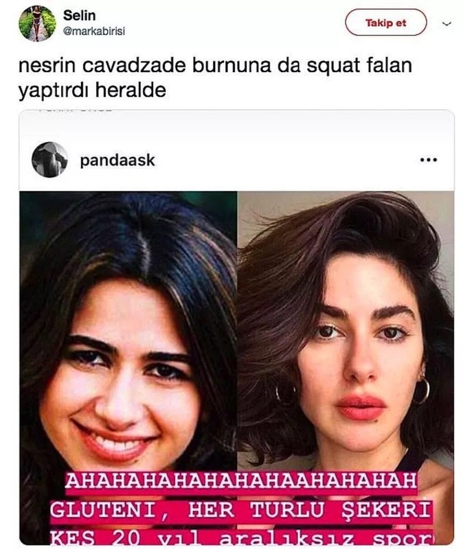 Üç Kuruş'un Bahar'ı Nesrin Cavadzade estetik iddialarını yalanlamıştı! O fotoğraflar ortaya çıktı! Görenler şok oldu - Resim: 8