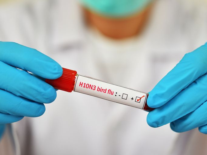 Dünya alarma geçti: H5N5 virüsü dünyada ilk kez can aldı! - Resim: 2