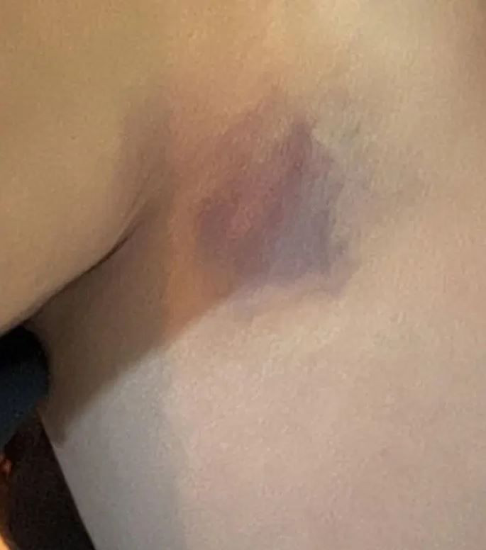 Yıldız Asyalı'dan yardım çağrısı: "Can güvenliğimiz yok!" diyerek şiddeti paylaştı - Resim: 4