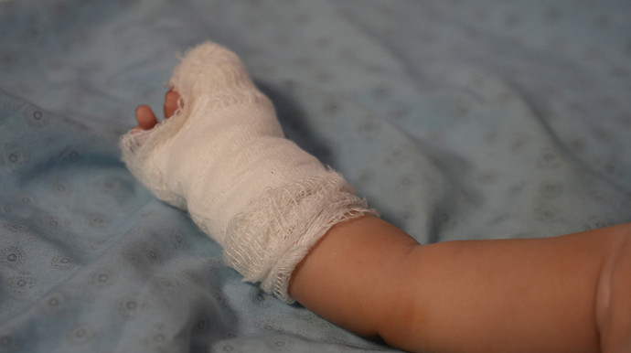 Hastanede skandal olay! Serum çıkarılırken 3 aylık bebeğin parmağı koptu - Resim : 1