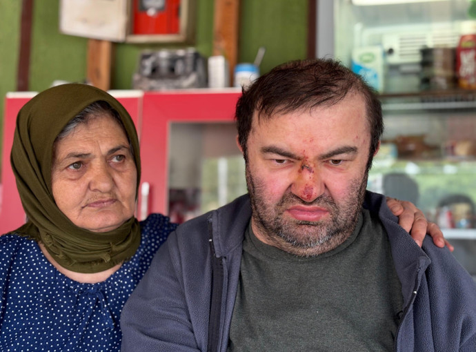 Bolu'da skandal olay! Yüzde 90 engelli vatandaş acımasızca darp edildi! - Resim : 1
