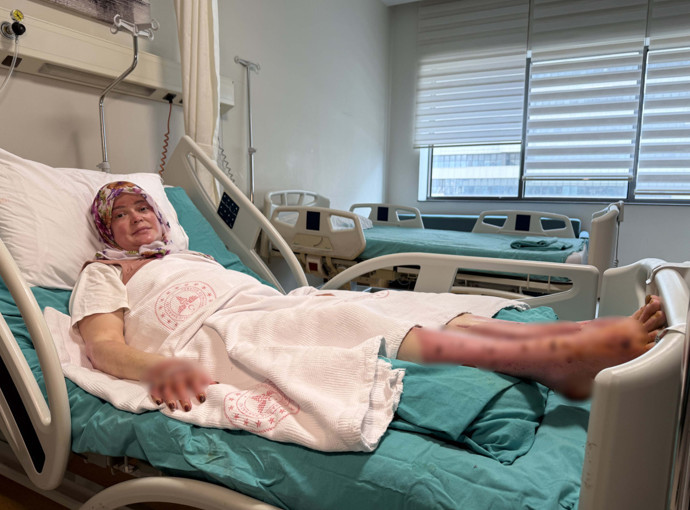 Çakmağı yaktı, karavan patladı! 16 gün uyutuldu: Alev topuna döndüm! 'Anne yanıyoruz...' - Resim : 2