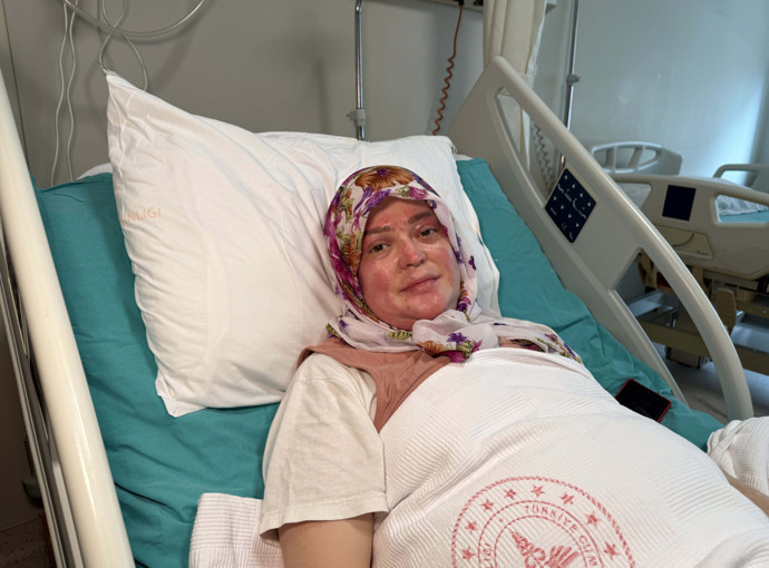 Çakmağı yaktı, karavan patladı! 16 gün uyutuldu: Alev topuna döndüm! 'Anne yanıyoruz...' - Resim : 3