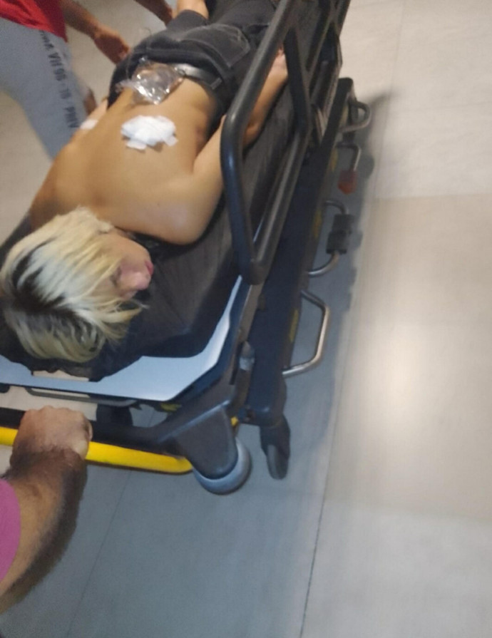 Aydın'da ikinci Ahmet Minguzzi vakası! Gasp etmeye çalıştılar: 15 yaşındaki Ukraynalı çocuğa korkunç saldırı - Resim : 1