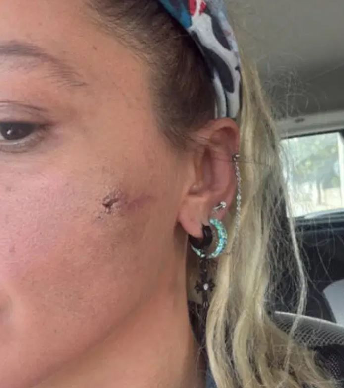 Yıldız Asyalı'dan yardım çağrısı: "Can güvenliğimiz yok!" diyerek şiddeti paylaştı - Resim: 3