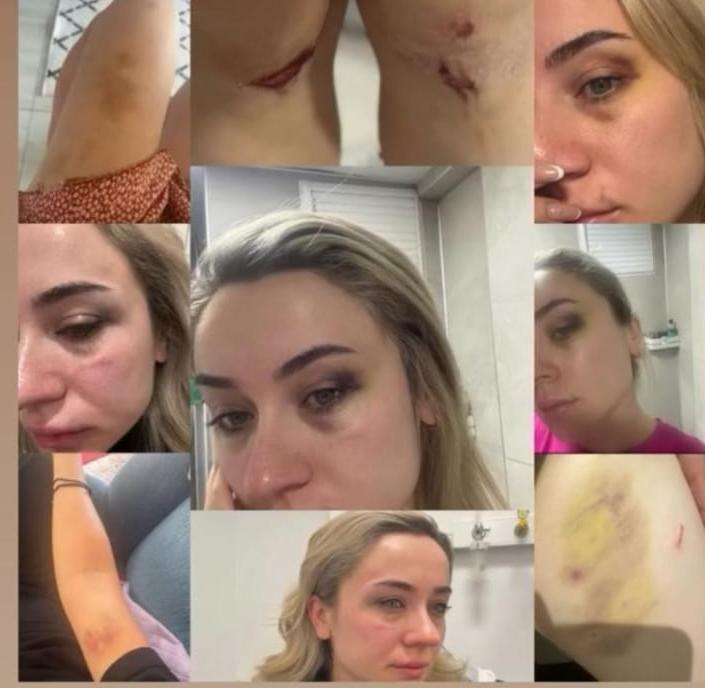 Elif öğretmen 'Beni yıllarca dövdü' dedi, ortalık karıştı! Stadyumda tekme tokat dövdüler - Resim : 1
