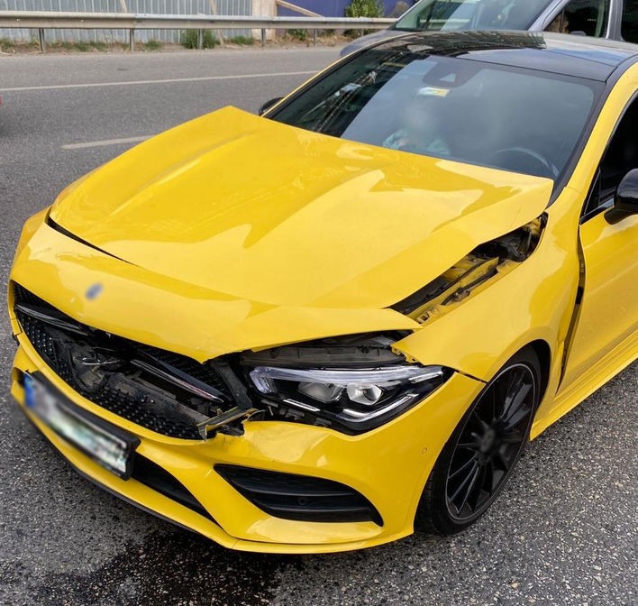 Genç şarkıcıdan korkutan haber! Klip çekimine giderden trafik kazası geçirdi - Resim : 2
