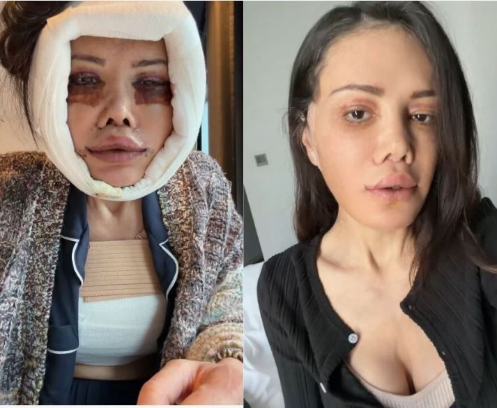 Yüz nakli sonrası hayatını kabusa dönmüştü! Didem Ceran Bali'de arınma ritüeline katıldı - Resim: 3