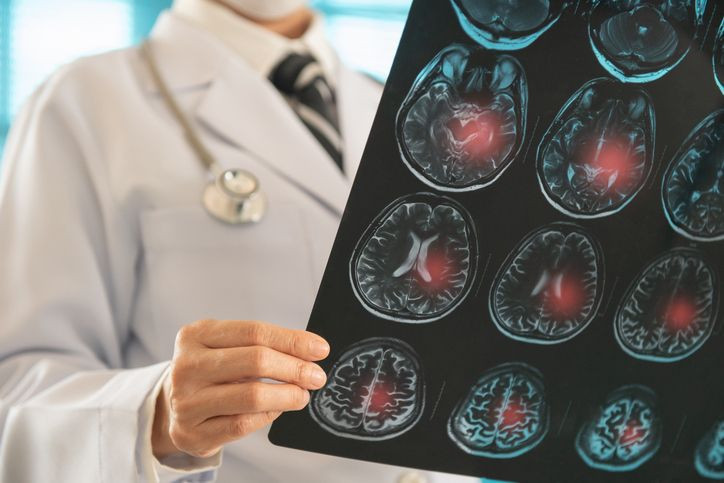 Dünyaya felaket salgın uyarısı yine verildi! Türkiye'de de 85 milyon bilmeli, vücuda sinsi sinsi giriyor - Resim: 14