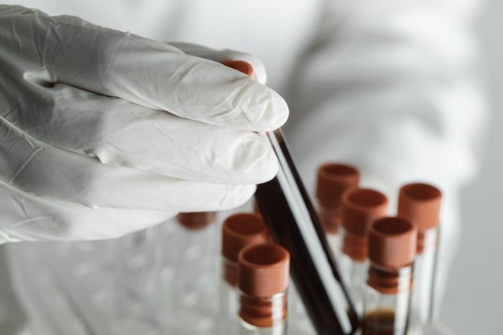 Uyuşturucu testiyle ilgili bilinmeyenler! Vücutta ne kadar süre kalır, saç boyamak test yanıltır mı? - Resim: 5