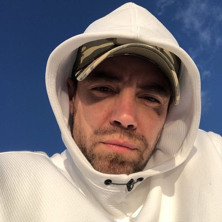 13. kez burun ameliyatı olmuştu! Murat Dalkılıç son halini paylaştı - Resim: 2