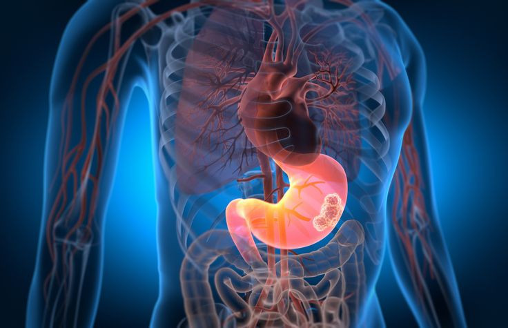 9 ayda tabuta gönderiyor! Korkunç kanser türünün 30 belirtisi ortaya çıktı - Resim: 6