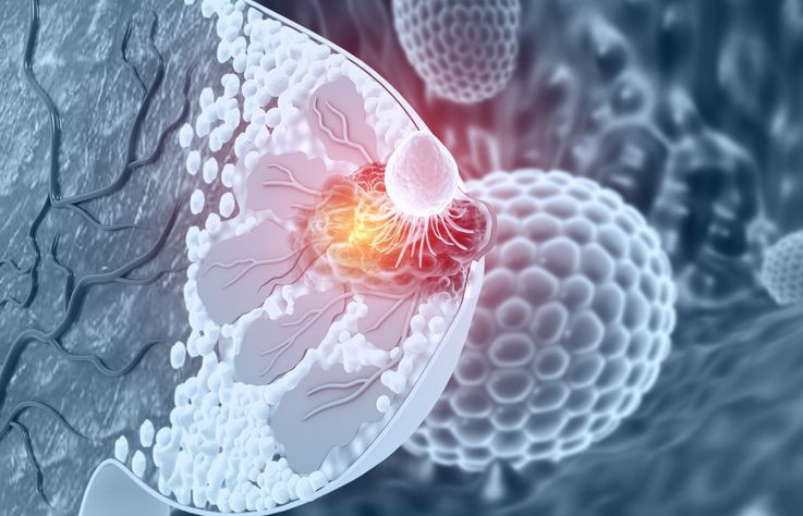 Türkiye'de 85 milyonun bilmesi lazım! Hiç belirti vermiyor, 3 ayda kara toprağa gömüyor - Resim: 15
